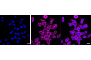 anti-Mucosa Associated Lymphoid Tissue Lymphoma Translocation Gene 1 (MALT1) antibody