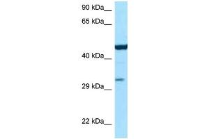 WB Suggested Anti-Asl Antibody Titration: 1. (ASL Antikörper  (C-Term))