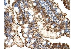PGK1 antibody was used for immunohistochemistry at a concentration of 4-8 ug/ml to stain Epithelial cells of intestinal villus (arrows) in Human Intestine.
