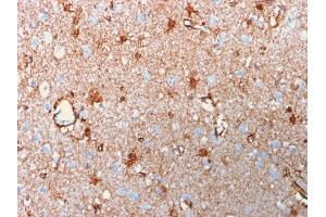 Formalin-fixed, paraffin-embedded human Brain stained with Purified S100B Mouse Recombinant Monoclonal Antibody (rS100B/1012).