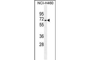 Western blot analysis in NCI-H460 cell line lysates (35ug/lane). (ZSCAN5B Antikörper  (C-Term))