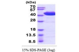 SDS-PAGE (SDS) image for Hematopoietic Cell Signal Transducer (HCST) (AA 20-48) (Active) protein (hIgG-His-tag) (ABIN7281338) (HCST Protein (AA 20-48) (hIgG-His-tag))