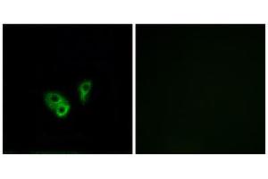 Immunofluorescence analysis of A549 cells, using CNGA2 antibody. (CNGA2 Antikörper  (Internal Region))