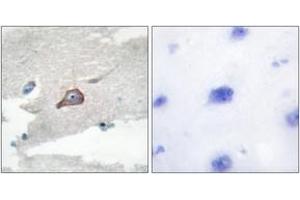 Immunohistochemistry (IHC) image for anti-Hemopoietic Cell Kinase (HCK) (AA 381-430) antibody (ABIN2888843) (HCK Antikörper  (AA 381-430))