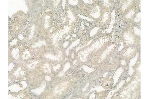 ABIN6257066 and ABIN6275007 at 1/100 staining human normal kidney tissue by IHC-P. (CLIC4 Antikörper  (N-Term))
