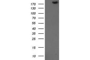 Image no. 1 for anti-SNF2 Histone Linker PHD RING Helicase, E3 Ubiquitin Protein Ligase (SHPRH) (AA 1-100) antibody (ABIN1490554) (SHPRH Antikörper  (AA 1-100))