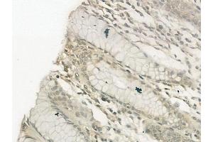 ABIN6257469 and ABIN6274751 at 1/100 staining human normal gastric tissue by IHC-P. (RPS19 Antikörper  (Internal Region))