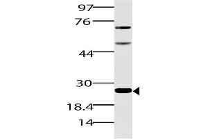 Image no. 1 for anti-Spi-B Transcription Factor (Spi-1/PU.1 Related) (SPIB) (AA 50-260) antibody (ABIN5027543) (SPIB Antikörper  (AA 50-260))