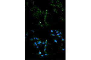 Immunofluorescence analysis of U2OS cells using MVP antibody.