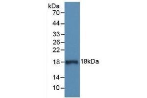 Detection of Recombinant C1INH, Human using Monoclonal Antibody to Complement 1 Inhibitor (C1INH) (SERPING1 Antikörper  (AA 399-500))