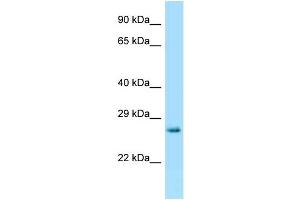 WB Suggested Anti-Hprt Antibody Titration: 1. (HPRT1 Antikörper  (C-Term))