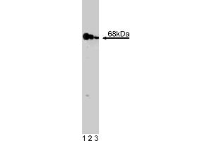 Western Blotting (WB) image for anti-Eukaryotic Translation Initiation Factor 2-alpha Kinase 2 (EIF2AK2) (AA 117-250) antibody (ABIN968165) (EIF2AK2 Antikörper  (AA 117-250))