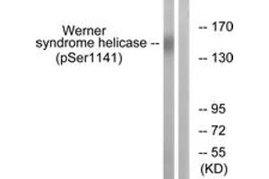 Western blot analysis of extracts from K562 cells treated with etoposide 25uM 24h, using Werner Syndrome Helicase (Phospho-Ser1141) Antibody. (RECQL2 Antikörper  (pSer1141))