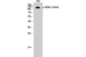Western Blotting (WB) image for anti-Histone Deacetylase 5 (HDAC5) (pSer498) antibody (ABIN3182025) (HDAC5 Antikörper  (pSer498))