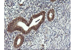 Immunohistochemistry (IHC) image for anti-T-cell surface glycoprotein CD1c (CD1C) antibody (ABIN2670676) (CD1c Antikörper)