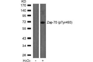 Image no. 2 for anti-zeta-Chain (TCR) Associated Protein Kinase 70kDa (ZAP70) (pTyr493) antibody (ABIN196887) (ZAP70 Antikörper  (pTyr493))