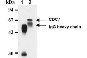 Western Blotting (WB) image for anti-Cell Division Cycle 7 (CDC7) antibody (ABIN487481) (CDC7 Antikörper)
