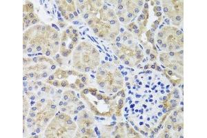 Immunohistochemistry of paraffin-embedded Mouse kidney using CGB7 Polyclonal Antibody at dilution of 1:100 (40x lens). (CGB7 Antikörper)