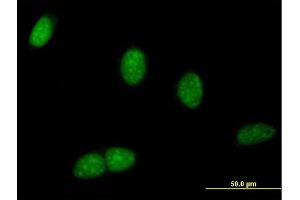 Immunofluorescence of purified MaxPab antibody to BRWD1 on HeLa cell.