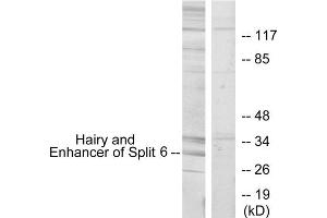 Western blot analysis of extracts from HeLa cells, using HES6 antibody. (HES6 Antikörper  (N-Term))