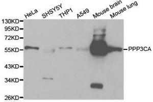 Western Blotting (WB) image for anti-Protein Phosphatase 3, Catalytic Subunit, alpha Isoform (PPP3CA) antibody (ABIN1874232) (PPP3CA Antikörper)