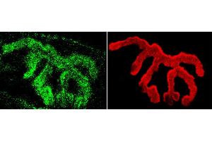 Immunohistochemistry analysis using Rabbit Anti-Piccolo Polyclonal Antibody . (Piccolo Antikörper  (APC))