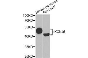 Western blot analysis of extracts of various cell lines, using KCNJ5 Antibody (ABIN1882359) at 1:1000 dilution.