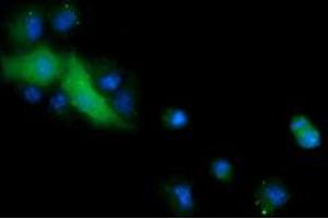 Image no. 3 for anti-Cancer/testis Antigen 1B (CTAG1B) antibody (ABIN1499891) (CTAG1B Antikörper)