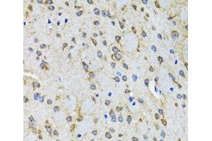 Immunohistochemistry of paraffin-embedded Rat brain using HTR2B Polyclonal Antibody at dilution of 1:100 (40x lens). (Serotonin Receptor 2B Antikörper)