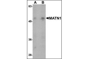 Western blot analysis of MATN1 in mouse liver tissue lysate with this product at (A) 1 and (B) 2 μg/ml. (MATN1 Antikörper  (N-Term))