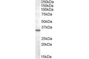 ABIN334364 (2µg/ml) staining of K562 lysate (35µg protein in RIPA buffer). (BDKRB1 Antikörper  (Internal Region))