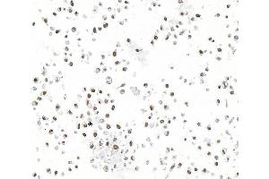 Immunocytochemistry (ICC) image for anti-Ataxia Telangiectasia Mutated (ATM) (AA 2550-2600) antibody (ABIN7795796)