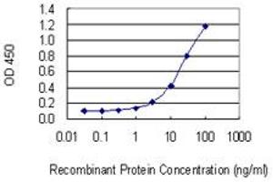 Detection limit for recombinant GST tagged SLC30A5 is 0. (SLC30A5 Antikörper  (AA 1-118))