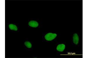 Immunofluorescence of purified MaxPab antibody to FLJ10826 on HeLa cell. (OGFOD1 Antikörper  (AA 1-542))