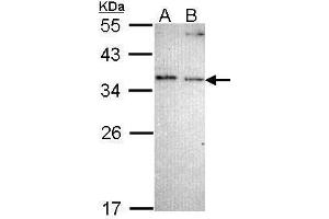 WB Image Sample (30 ug of whole cell lysate) A: A431 , B: H1299 12% SDS PAGE antibody diluted at 1:1000 (NOSIP Antikörper)