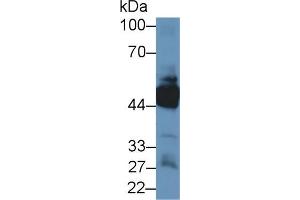 Western blot analysis of Human Lung lysate, using Human KRT33A Antibody (1 µg/ml) and HRP-conjugated Goat Anti-Rabbit antibody ( (Keratin 33A Antikörper  (AA 57-363))