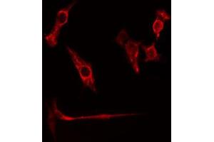 ABIN6274774 staining HuvEc cells by IF/ICC. (RPL26L1 Antikörper  (C-Term))