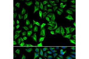 Immunofluorescence analysis of A549 cells using GDA Polyclonal Antibody (GDA Antikörper)