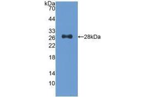 Western blot analysis of recombinant Human CDK9. (CDK9 Antikörper  (AA 104-315))