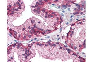 Anti-EGFR antibody IHC of human prostate. (EGFR Antikörper  (Internal Region))