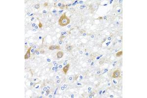 Immunohistochemistry of paraffin-embedded rat brain using NRG4 antibody at dilution of 1:100 (40x lens). (Neuregulin 4 Antikörper)