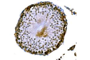 IHC analysis of DMC1 using anti-DMC1 antibody (ABIN7601468).