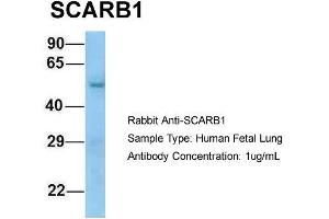 Host: Rabbit  Target Name: SCARB1  Sample Tissue: Human Fetal Lung  Antibody Dilution: 1.