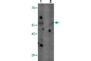Western blot analysis of SHQ1 in human heart tissue with SHQ1 polyclonal antibody  at 1 ug/mL in (1) the absence and (2) the presence of blocking peptide. (SHQ1 Antikörper  (N-Term))