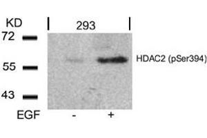 Image no. 3 for anti-Histone Deacetylase 2 (HDAC2) (pSer394) antibody (ABIN319237) (HDAC2 Antikörper  (pSer394))