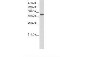 Image no. 1 for anti-Tyrosyl-tRNA Synthetase (Yars) (AA 451-500) antibody (ABIN202719)