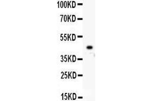 Western Blotting (WB) image for anti-Homeobox A10 (HOXA10) (AA 57-340) antibody (ABIN3042453)