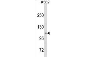 Western Blotting (WB) image for anti-Calsyntenin 2 (CLSTN2) antibody (ABIN3001117) (Calsyntenin 2 Antikörper)
