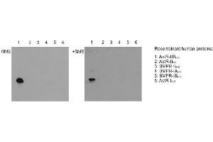 Western blot with extracellular domains (ecd) of different related human receptors (50ng per lane) reveals that anti-Activin Receptor IIB, pAb (IG-510)  (dilution 1:5000) specifically recoginzes ACTR-IIB under nonreducing (-ßME, left panel) and reducing (+ßME; right panel) conditions, but none of the other receptor types tested.