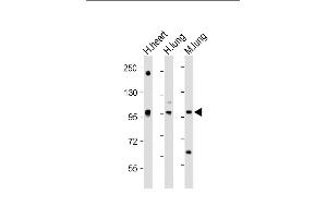 All lanes : Anti-VSGP/F-spondin Antibody (N-term) at 1:2000 dilution Lane 1: Human heart lysate Lane 2: Human lung lysate Lane 3: Mouse lung lysate Lysates/proteins at 20 μg per lane. (SPON1 Antikörper  (N-Term))